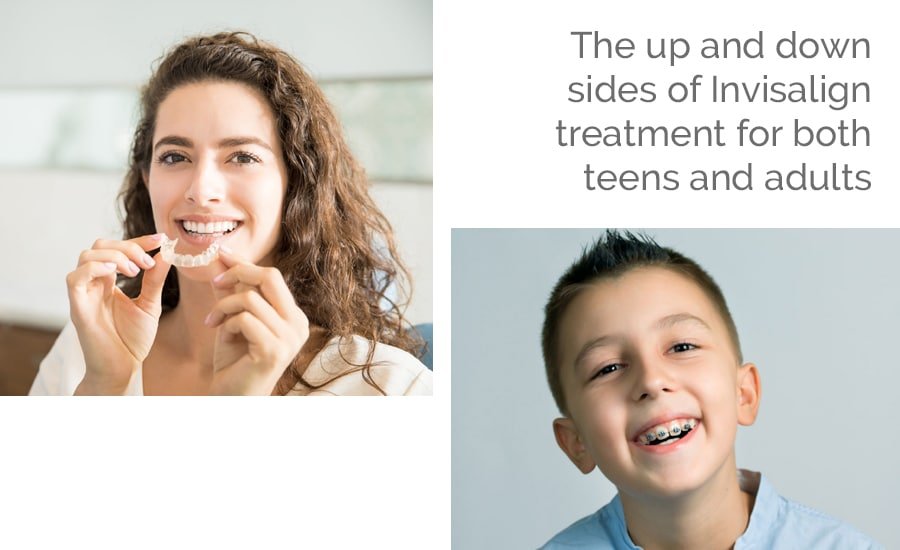 Invisalign treatment