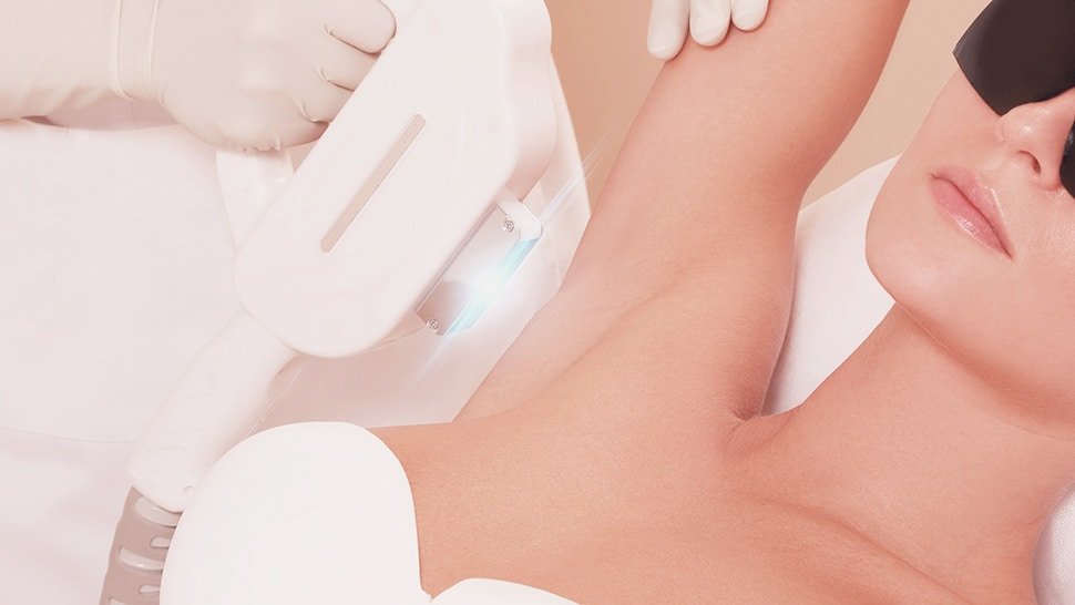 ipl hair removal treatment