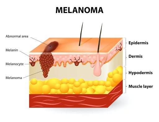  UV rays effect our skin