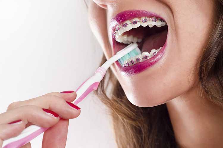  Wear that Smile Confidently: Perfect Teeth with Perfect Hygiene