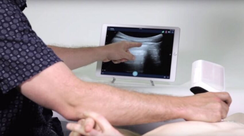 Wireless Ultrasound Machine