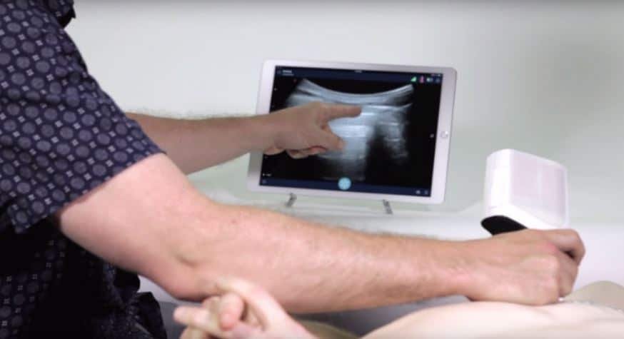 Wireless Ultrasound Machine