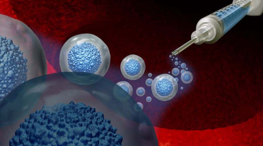 Stem Cell Therapy