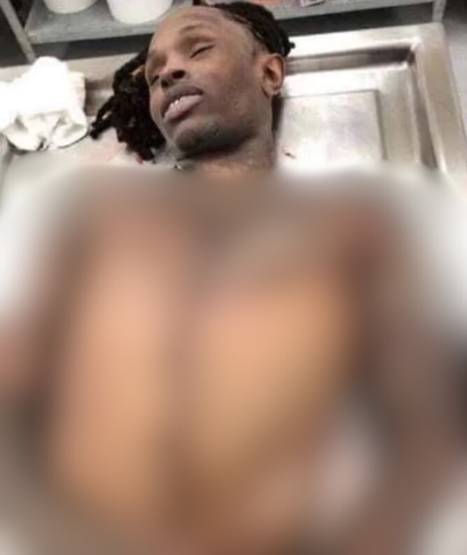 King Von Autopsy Photo