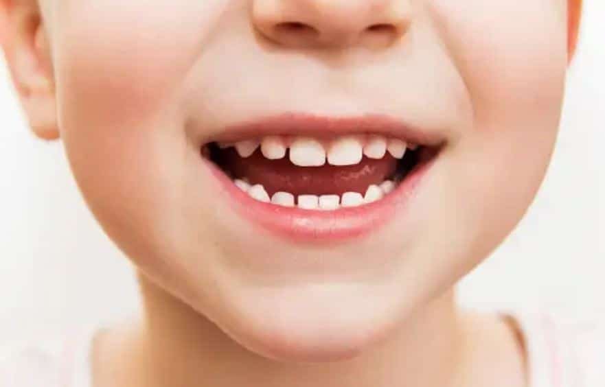 Kids' Teeth Healthy