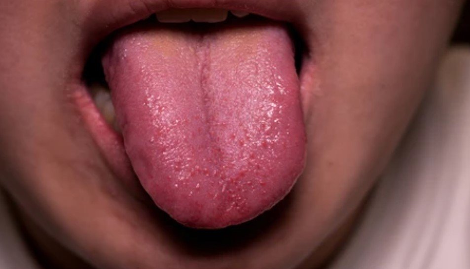 Taste Buds Sensitive to Bitter
