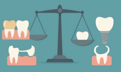 Dental Implants vs Other Options