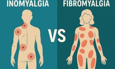 Inomyalgia vs Fibromyalgia
