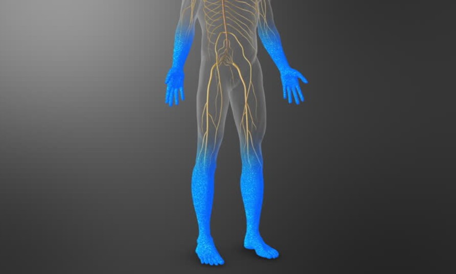 Neuropathy
