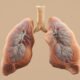 Respiratory Health Therapies